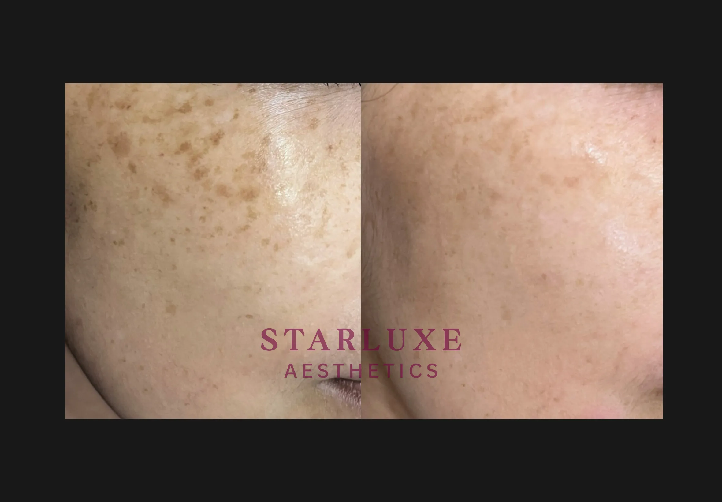 Skin transformation