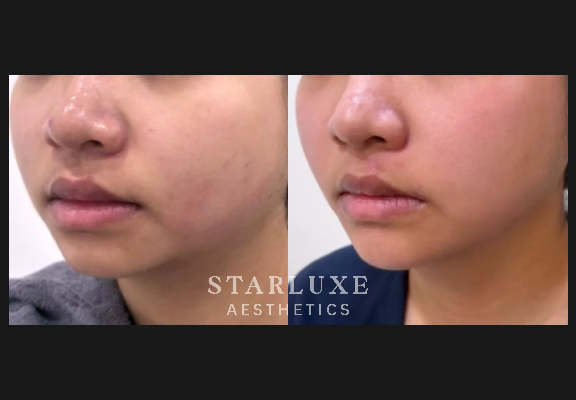 Skin transformation