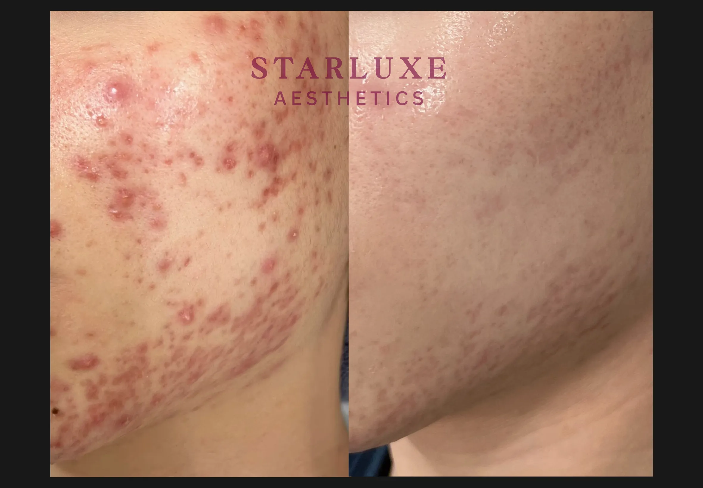 Skin transformation